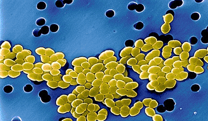 Image: Colored scanning electron micrograph (SEM) of Vancomycin-resistant Enterococci (VRE) (photo courtesy Science Source).